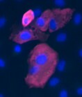 SARS-CoV-2 Spike S1 Subunit Antibody MAB105403