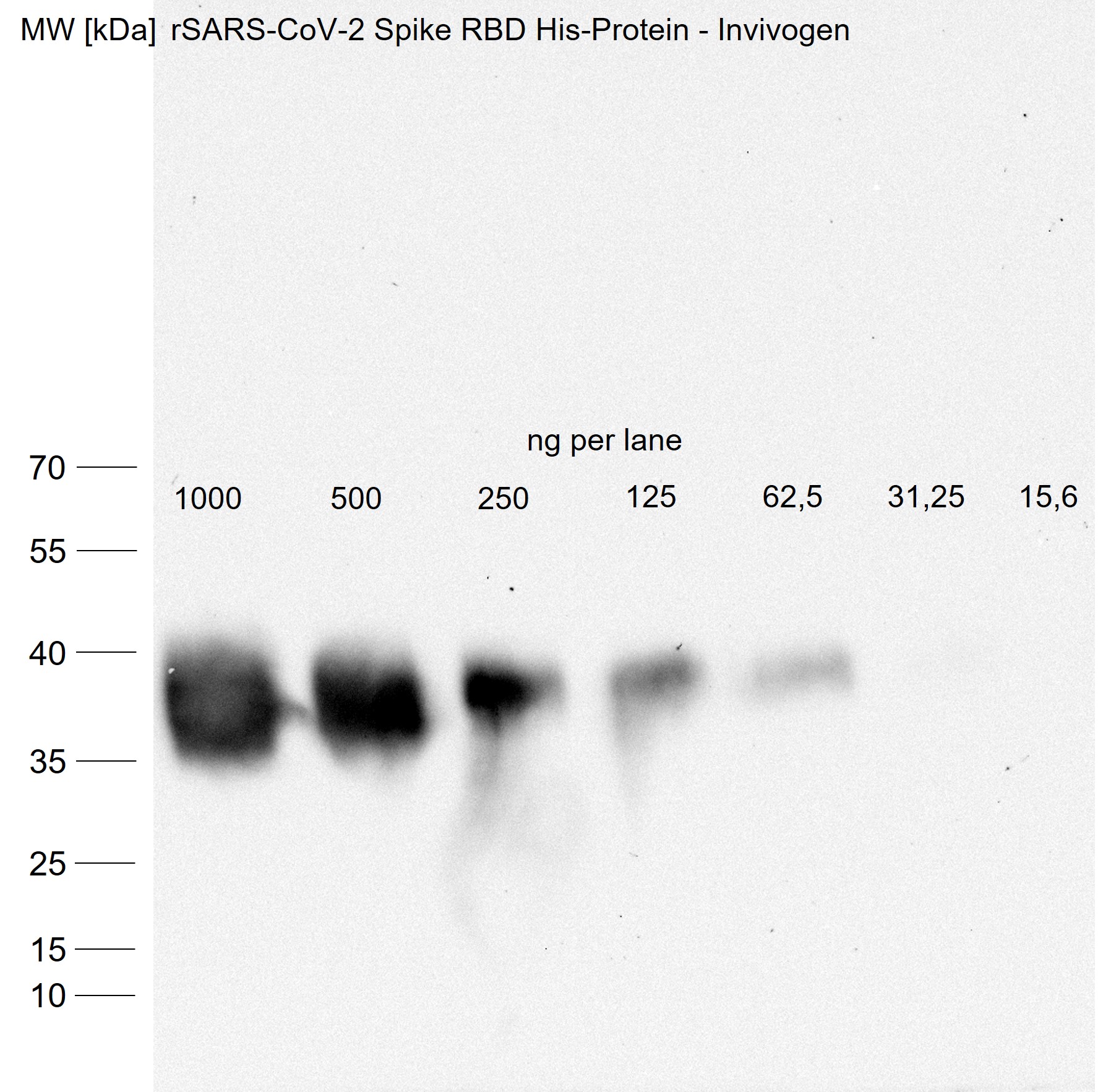 SARS-CoV-2 Spike RBD Antibody MAB10540