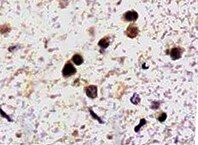 Human Tau Antibody MAB106291