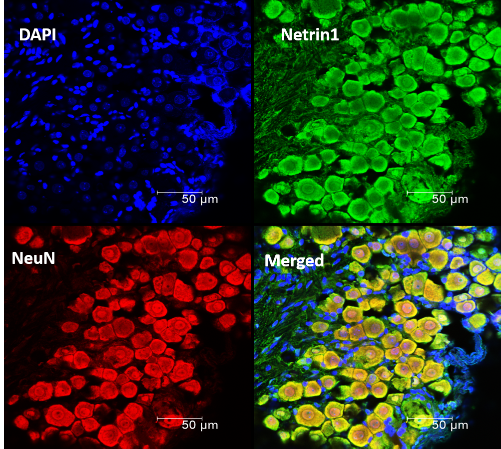 Mouse Netrin‑1 Antibody MAB1109