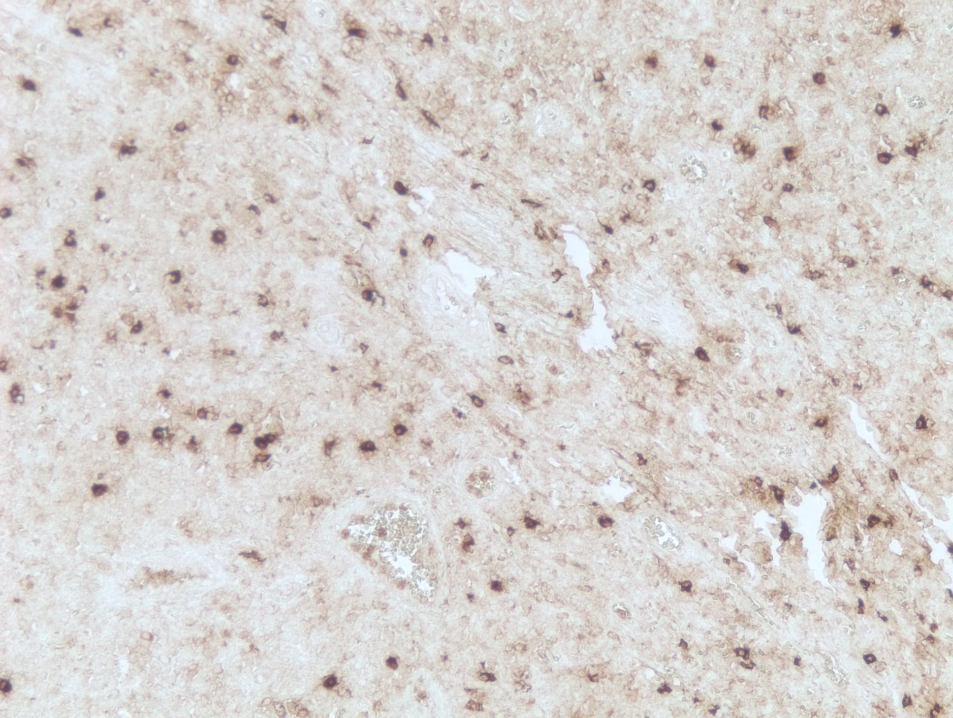 Human Siglec‑3/CD33 Antibody MAB11371