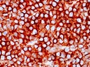 Human Siglec‑3/CD33 Antibody MAB11371