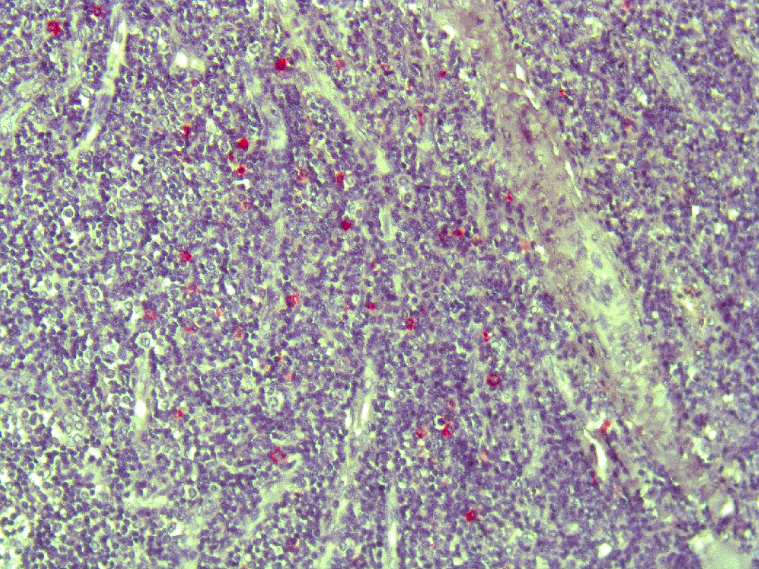 Human Siglec‑3/CD33 Antibody MAB11371