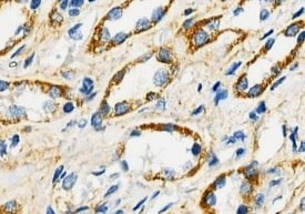 Human MMP‑25/MT6-MMP Hemopexin Domain Antibody MAB11421