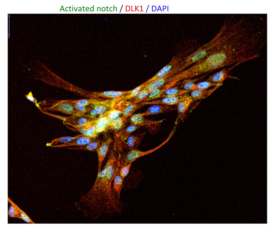 Human Pref‑1/DLK1/FA1 Antibody MAB1144