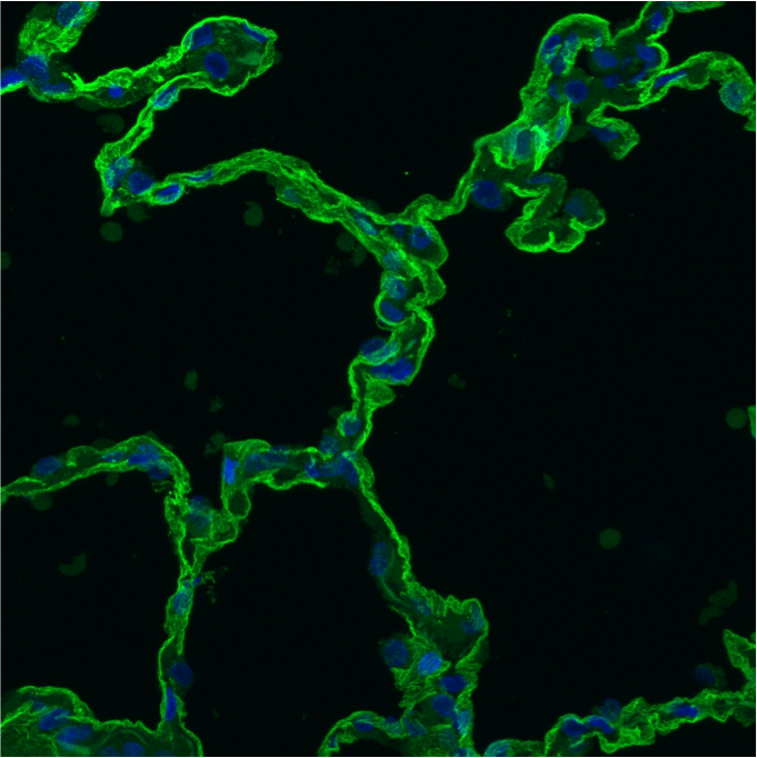 Human RAGE/AGER Antibody MAB11451