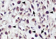 Human RAGE Antibody MAB1145