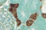Human Galectin‑1 Antibody MAB1152