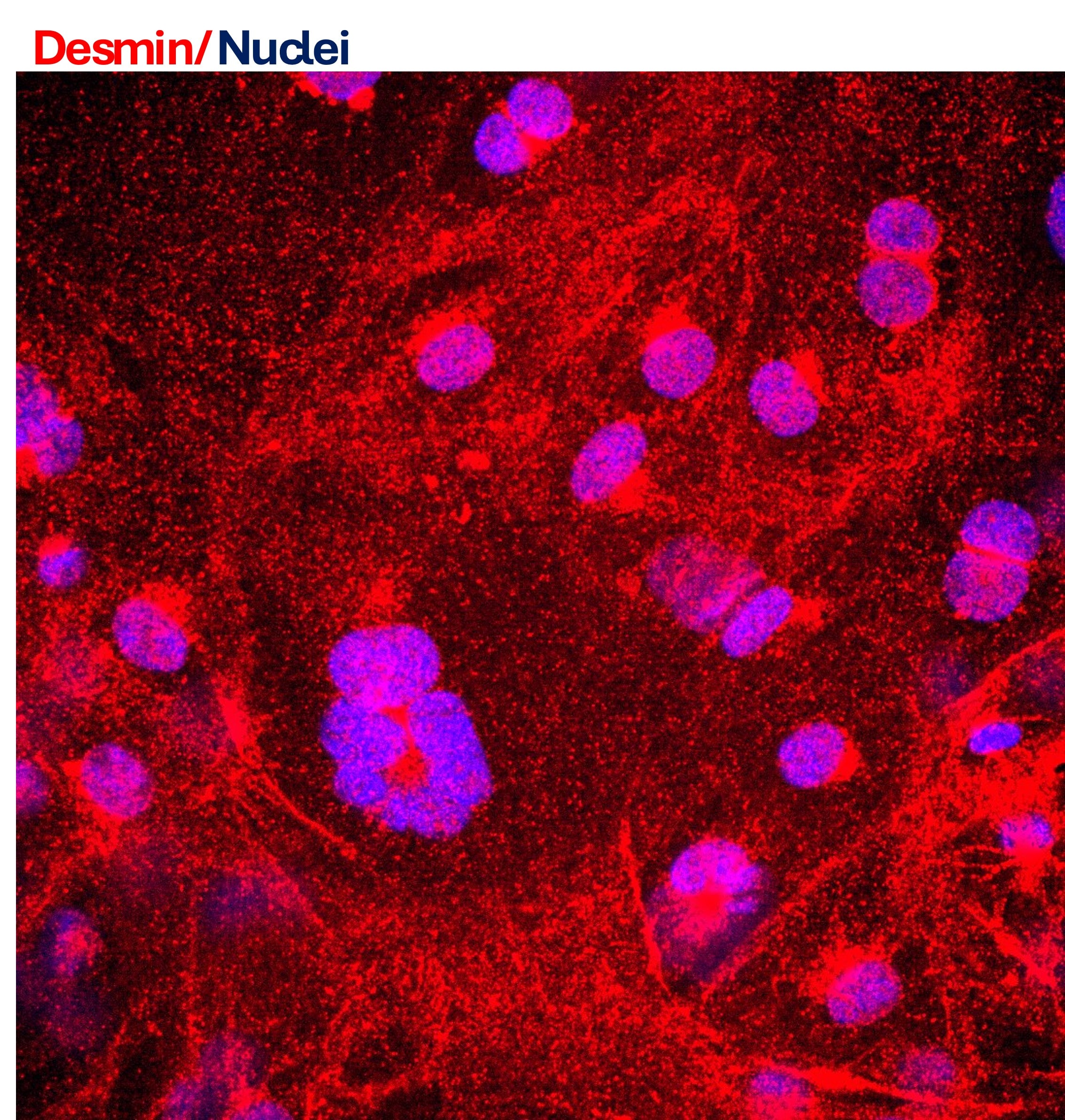 Human Desmin Antibody MAB11607