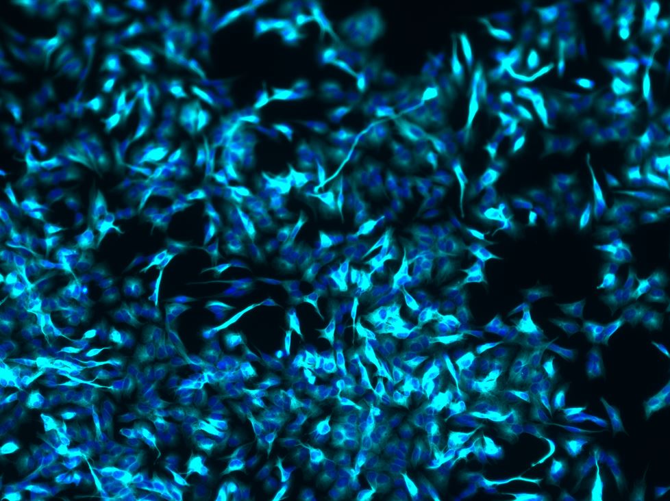 Neuron-specific  beta ‑III Tubulin Antibody MAB1195