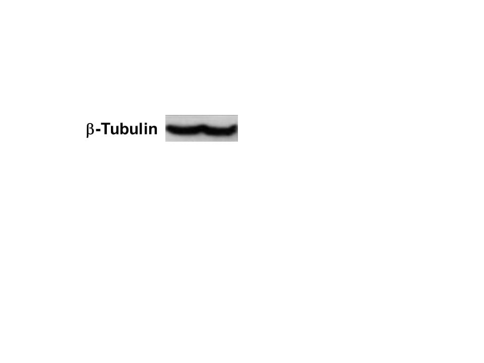 Neuron-specific  beta ‑III Tubulin Antibody MAB1195