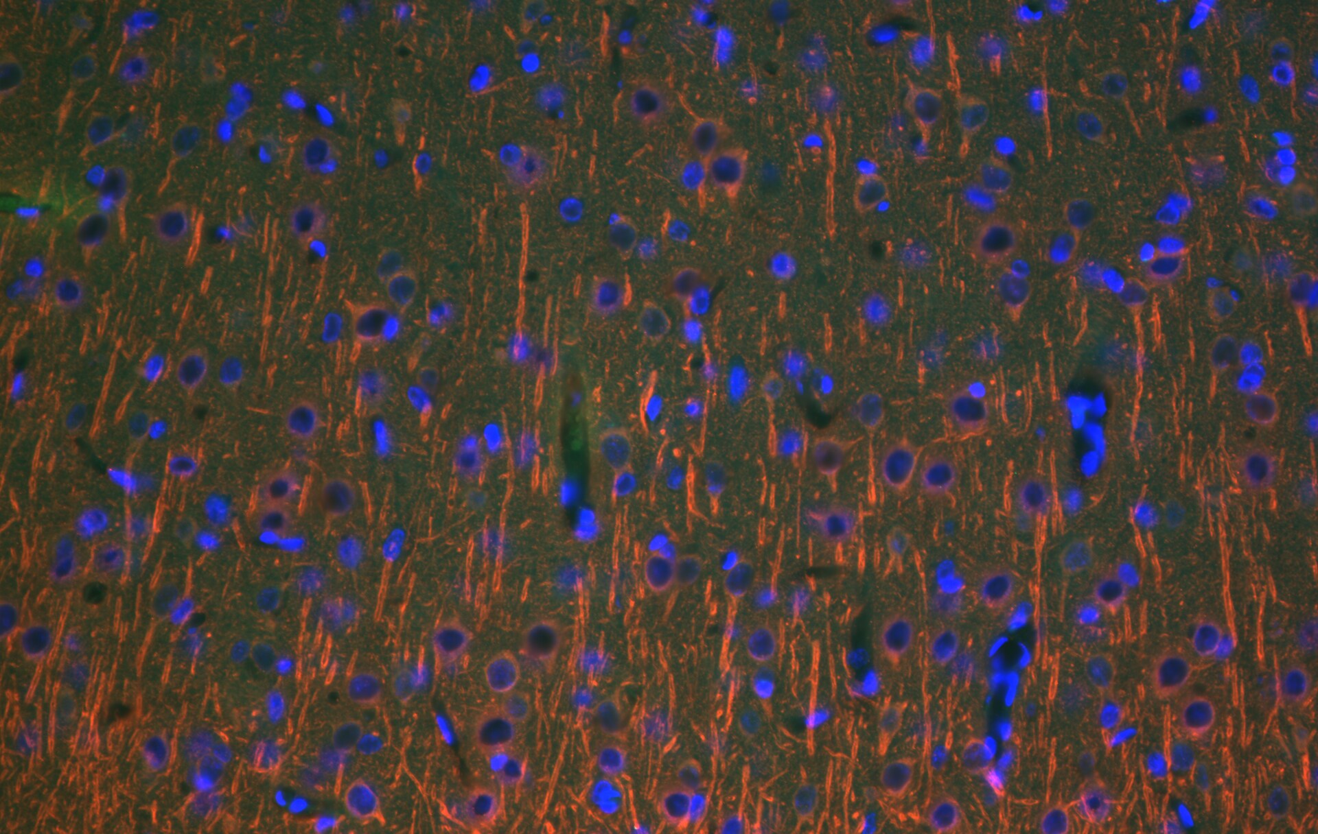 Neuron-specific  beta ‑III Tubulin Antibody MAB1195