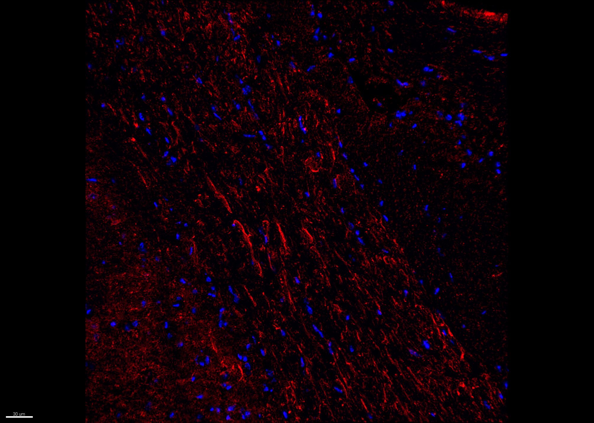 Neuron-specific  beta ‑III Tubulin Antibody MAB1195