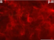 Neuron-specific  beta ‑III Tubulin Antibody MAB1195