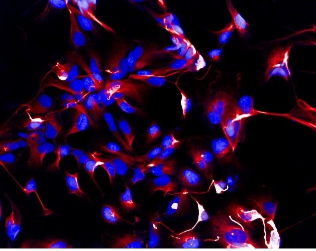 Neuron-specific  beta ‑III Tubulin Antibody MAB1195