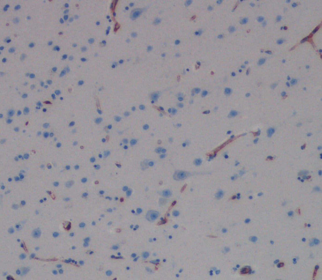 Human Cystatin C Antibody MAB11962