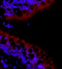 Human IL-17RB Antibody MAB1207