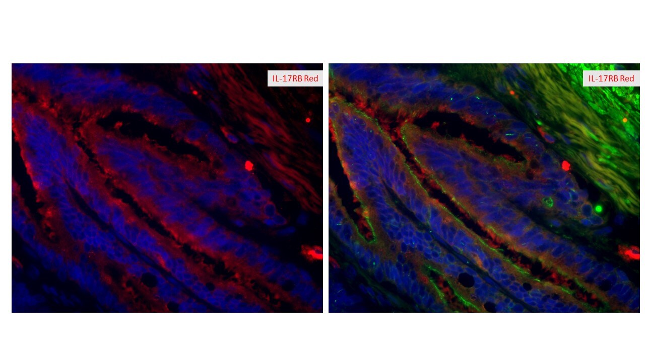Human IL-17RB Antibody MAB1207