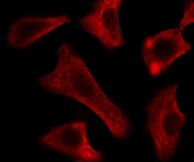 Human Integrin  alpha V/CD51 Antibody MAB12191