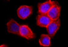 Human Integrin  alpha V/CD51 Antibody MAB1219