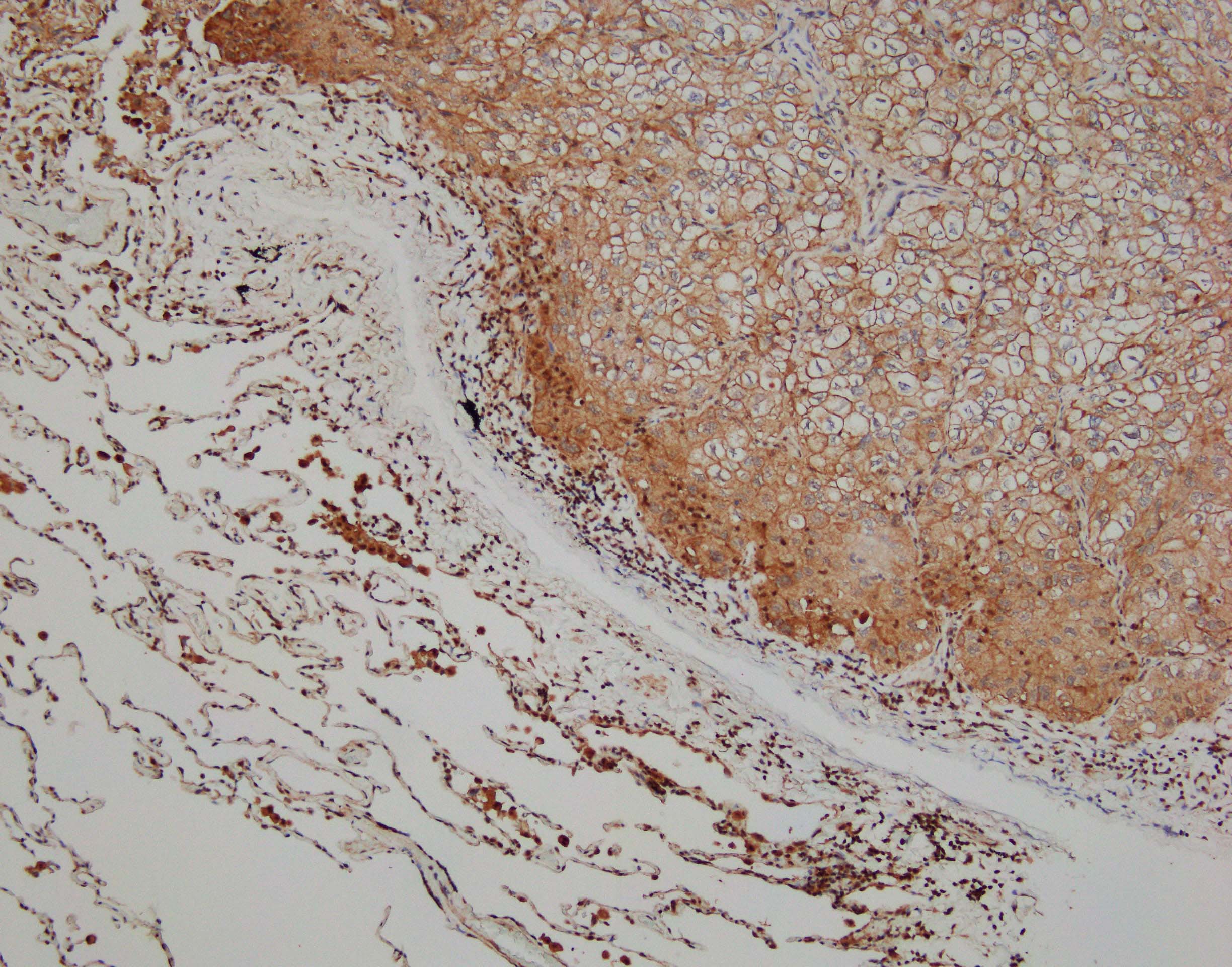 Human PD‑L2/B7‑DC Antibody MAB1224