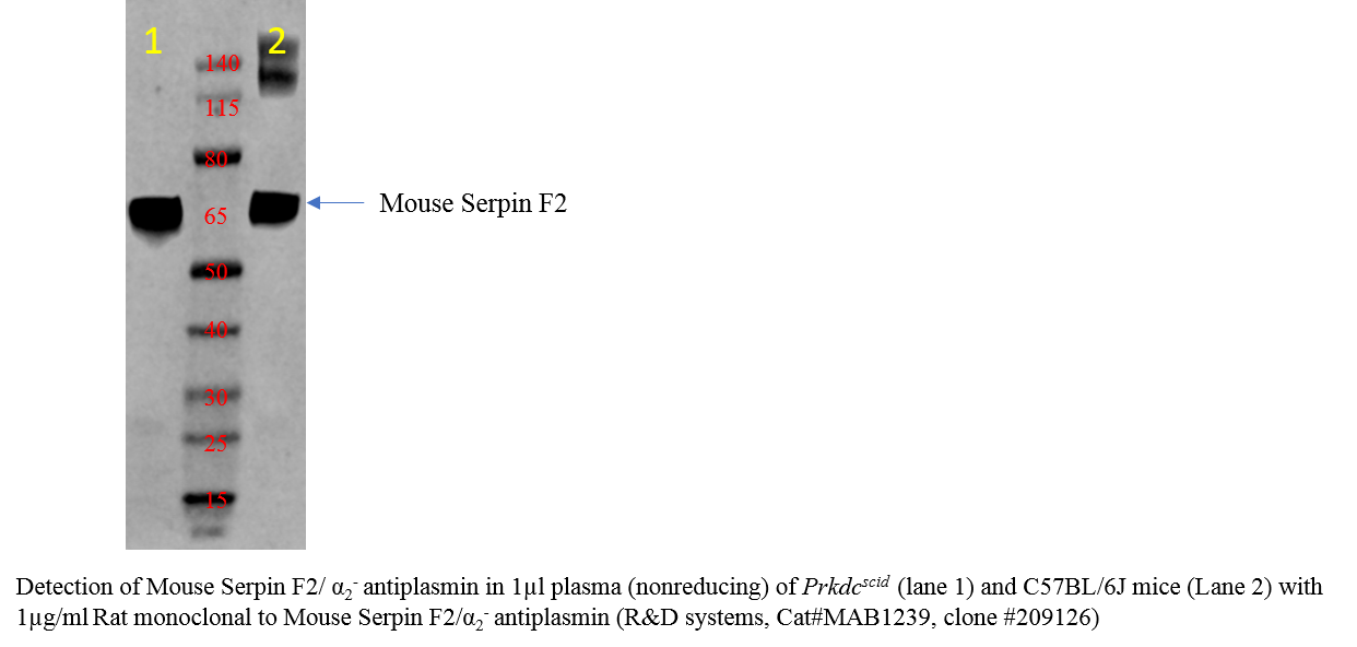 Mouse Serpin F2/ alpha 2‑Antiplasmin Antibody MAB1239