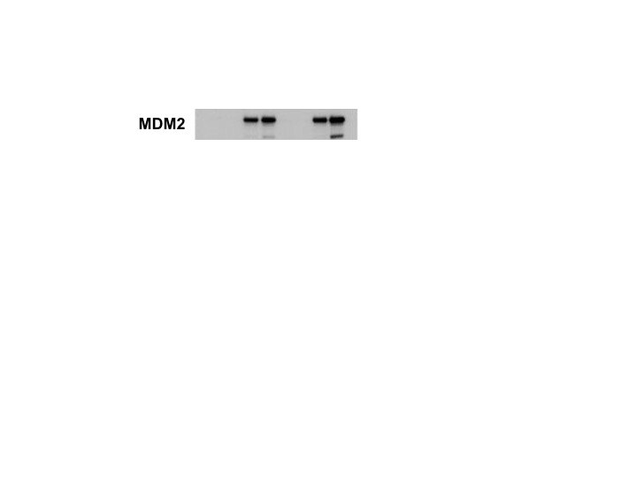 Human MDM2/HDM2 Antibody MAB1244