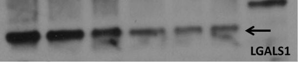 Mouse Galectin‑1 Antibody MAB1245