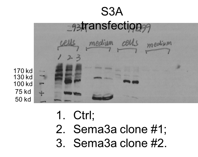 Human Semaphorin 3A Antibody MAB1250