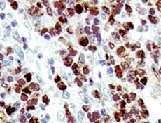 Human Fc gamma  RI/CD64 Antibody MAB12574