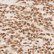 Human Fc gamma  RI/CD64 Antibody MAB12574
