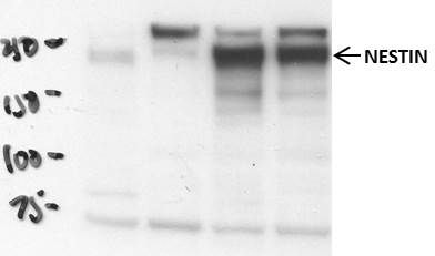 Human Nestin Antibody MAB1259
