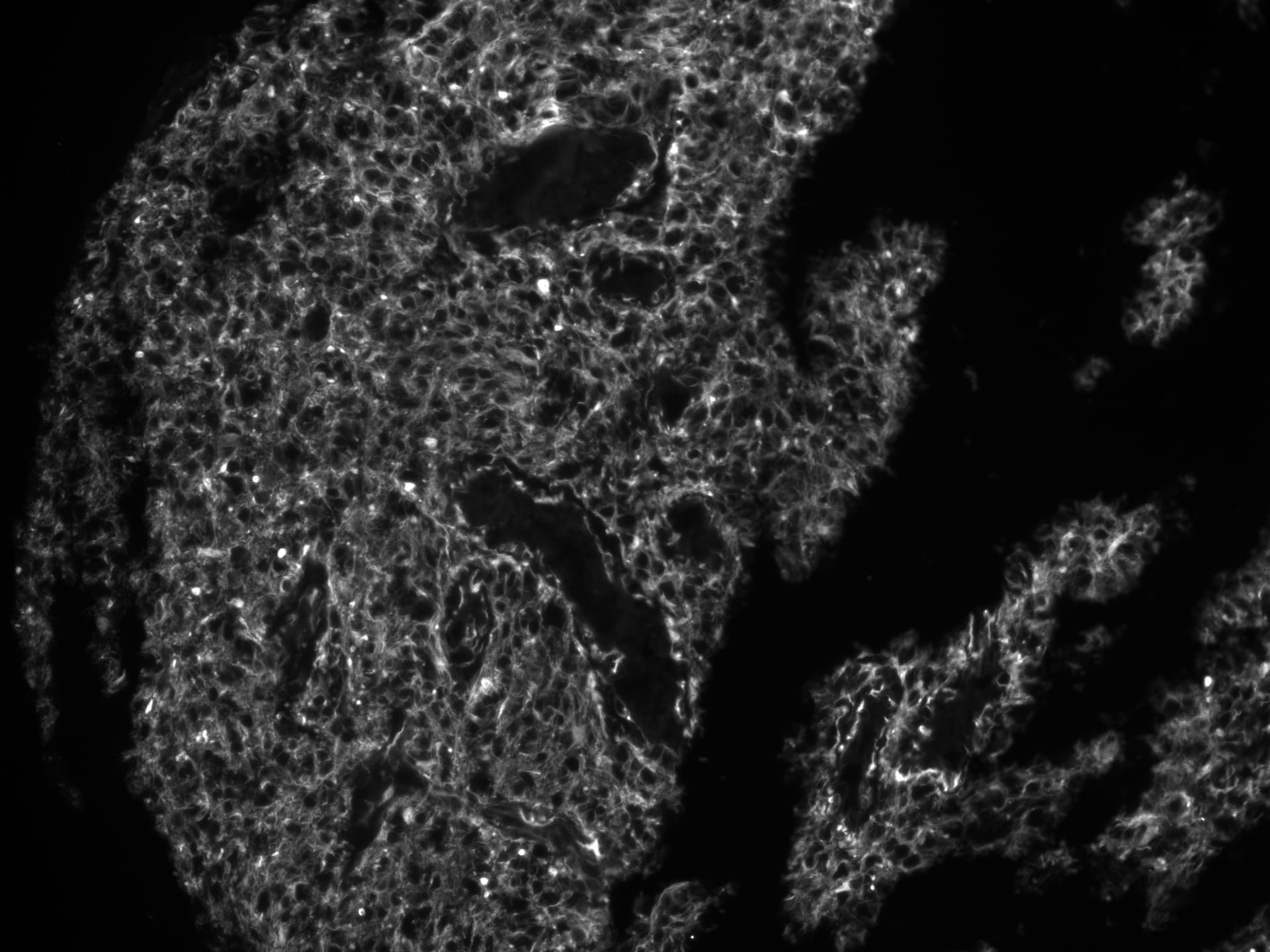 Human Nestin Antibody MAB1259
