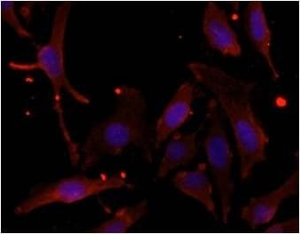 Human Nestin Antibody MAB1259