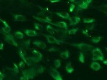 Human Nestin Antibody MAB1259