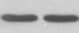 Human Fas Ligand/TNFSF6 Antibody MAB1261