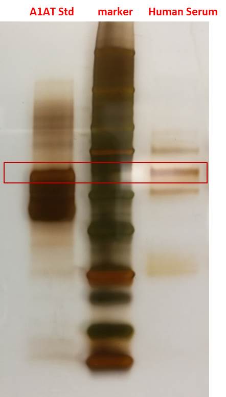 Human Serpin A1/ alpha 1‑Antitrypsin Antibody MAB1268