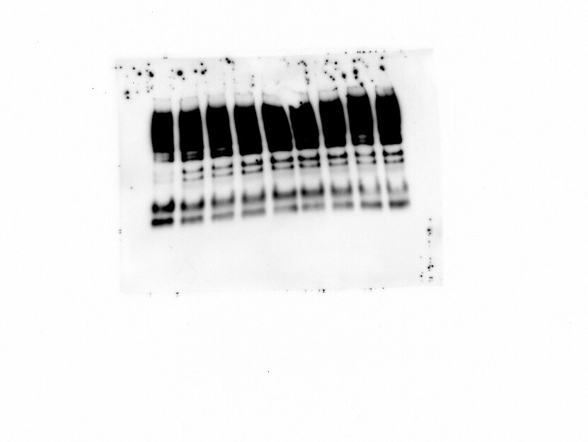 Human Serpin A1/ alpha 1‑Antitrypsin Antibody MAB1268