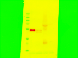 Human Cathepsin E Antibody MAB1294