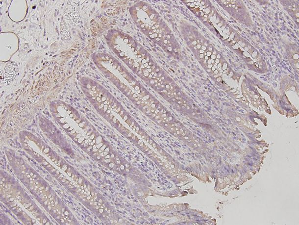 Mouse Galectin‑7 Antibody MAB1304