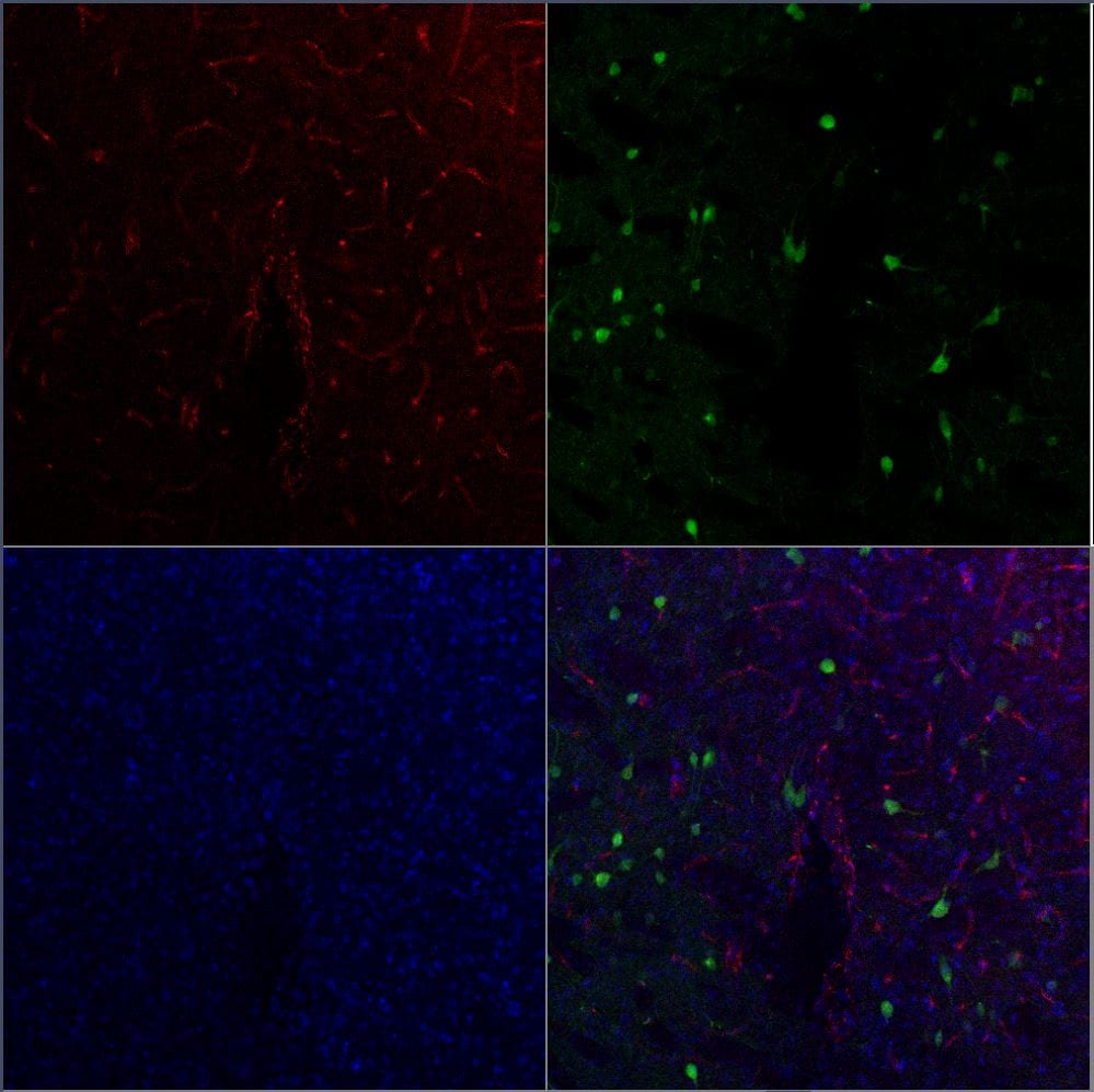 Mouse Endoglin/CD105 Antibody MAB1320