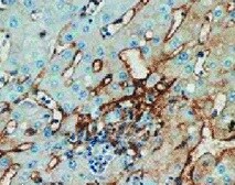 Mouse Endoglin/CD105 Antibody MAB1320