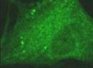 Human beta-Catenin Antibody MAB13291