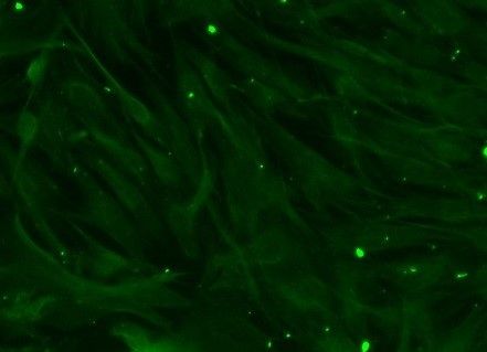 Human beta-Catenin Antibody MAB13291