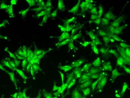 Human beta-Catenin Antibody MAB13291