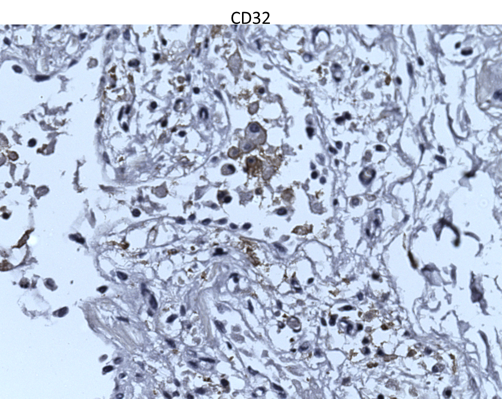 Human Fc gamma  RII/CD32 Antibody MAB1330