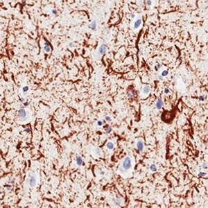 Human alpha-Synuclein Antibody MAB13383