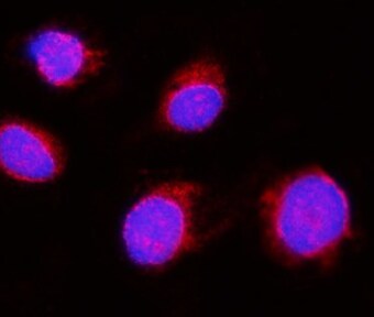Human Kallikrein 3/PSA Antibody MAB13443