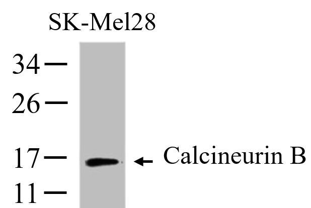 Human/Mouse/Rat Calcineurin B Antibody MAB1348