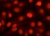 Human/Mouse/Rat p53 Antibody MAB1355